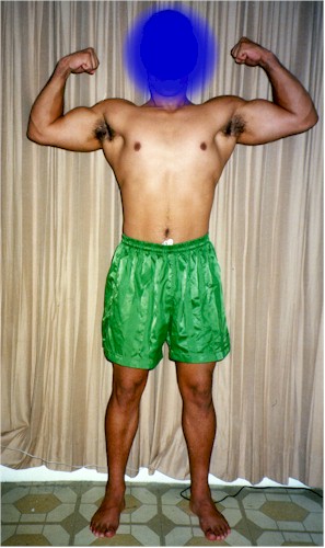 Front Double Biceps (After)